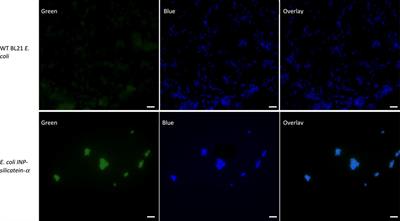 Surface-displayed silicatein-α enzyme in bioengineered E. coli enables biocementation and silica mineralization